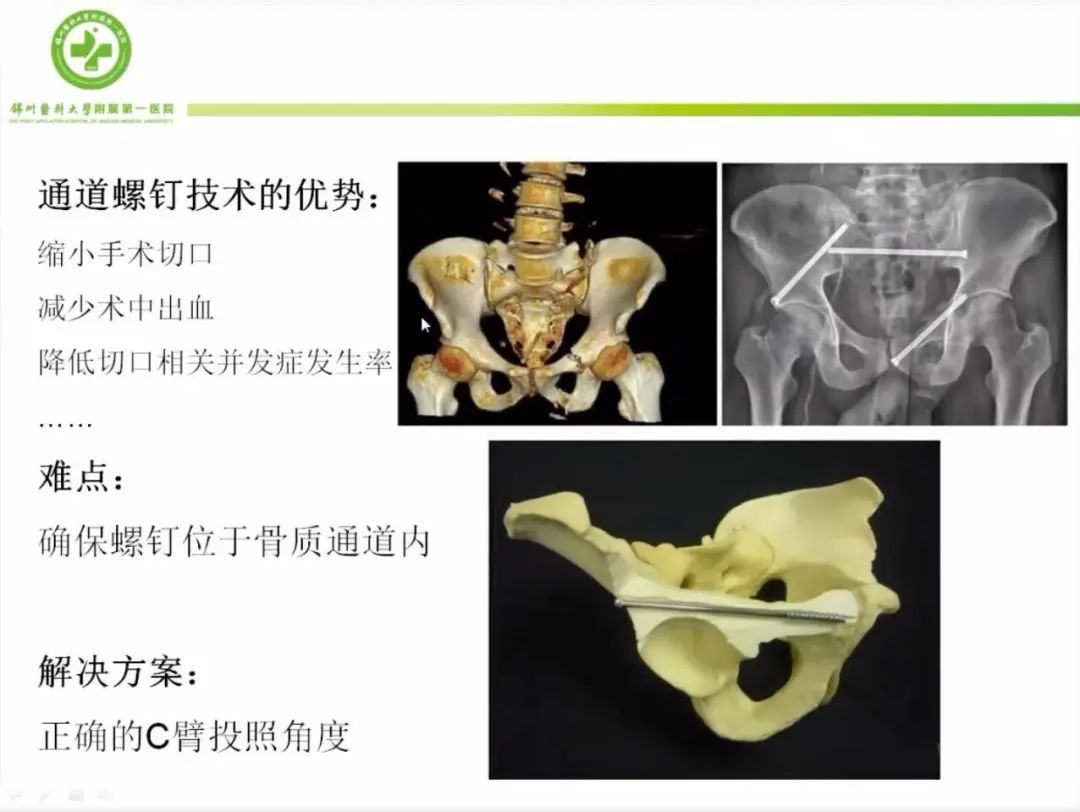 聚焦显微外科|葫芦岛市医学会显微外科学分会第一届第二次学术会议顺利召开(图11)