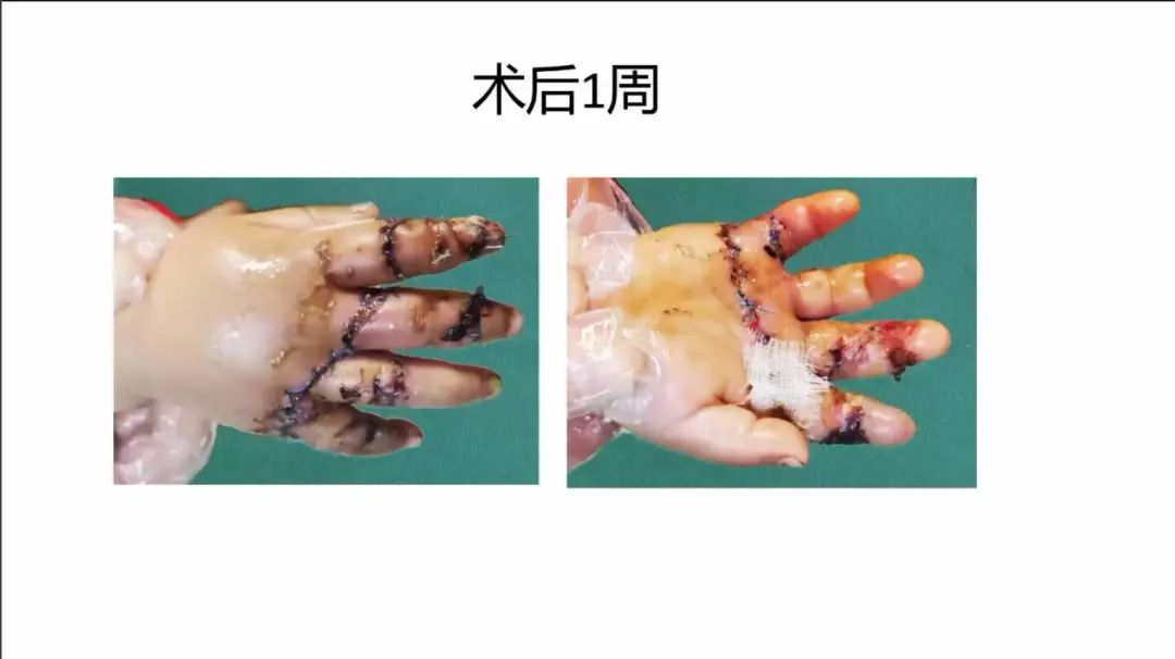 聚焦显微外科|葫芦岛市医学会显微外科学分会第一届第二次学术会议顺利召开(图25)